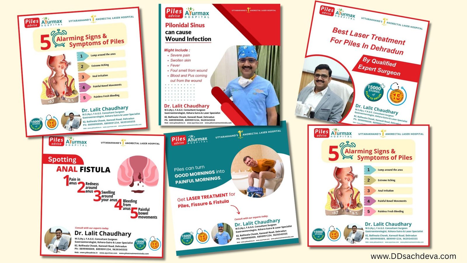 Digital Marketing for Doctors in Dehradun - case study dr lalit chaudhry piles advise dehradun